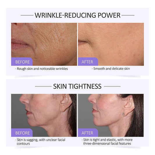 Collagen Face Serum – Anti-Aging Firming & Hydrating Skin Booster (Instant Lift Formula)
